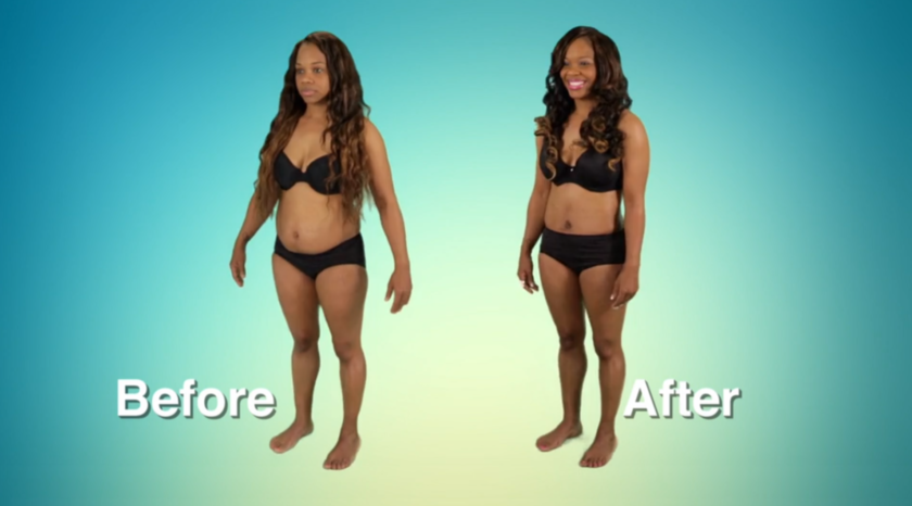 Atlanta Plastic Season 2 Before and After